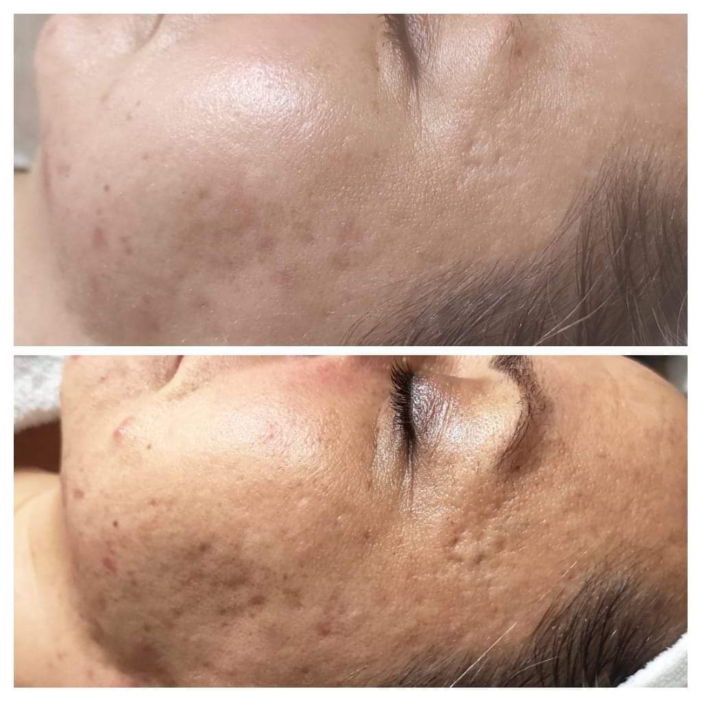 Masáže v Salon Rose